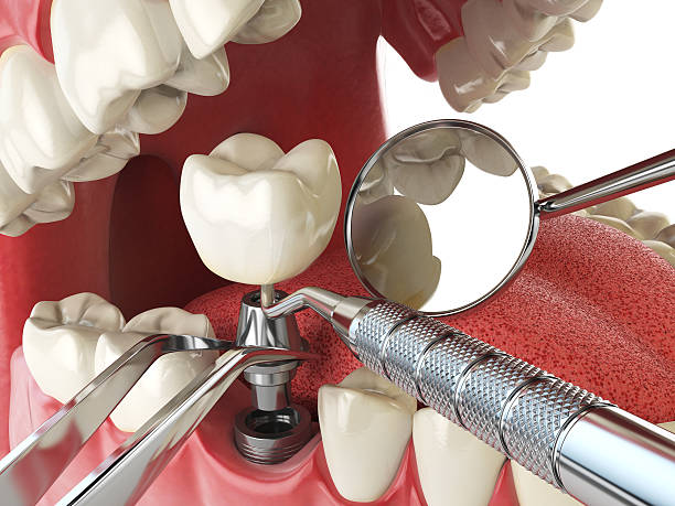 Best Urgent Dental Care in Mexico, IN